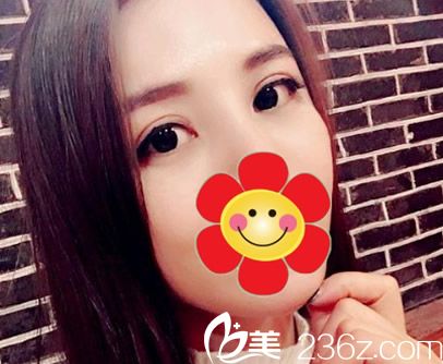 眼霜和手术去眼袋哪个好 ​我在呼和浩特紫洁整形做的是超声波去眼袋