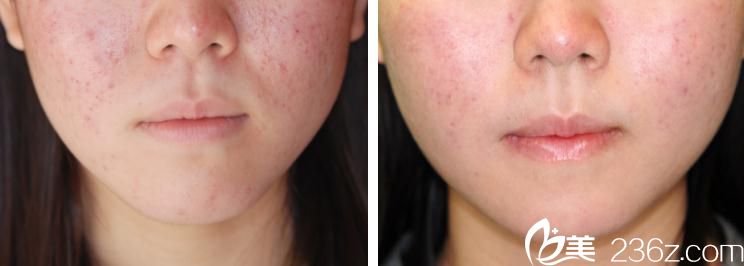 20181119_1542605739248433.jpg 20181119_1542605739248433.jpg