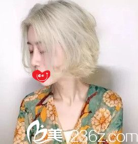 假体隆鼻2个月鼻子完全消肿 假体隆鼻2个月鼻子完全消肿