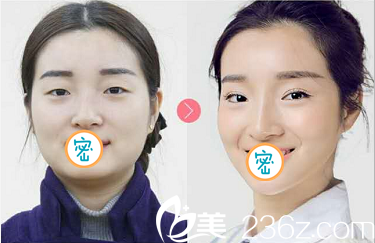 芭比电眼真人案例 芭比电眼真人案例