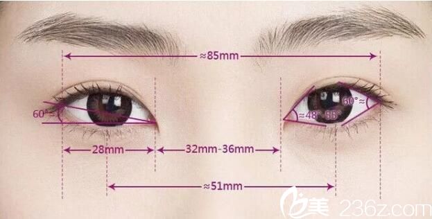 双眼皮失败修复方法 双眼皮失败修复方法