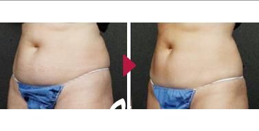 先端机器瘦身术 先端机器瘦身术