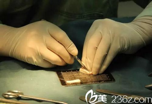 雕刻中的肋软骨