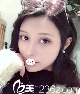 <!--<i data=20240703-sp></i>-->陈茂年假体隆鼻综合整形<span style= <!--<i data=20240703-sp></i>-->陈茂年假体隆鼻综合整形<span style=