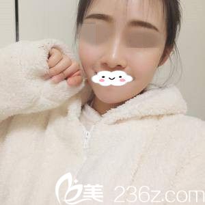 术后一周的效果 术后一周的效果