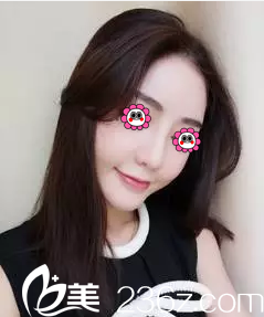 医生给我做隆鼻第2天效果 医生给我做隆鼻第2天效果