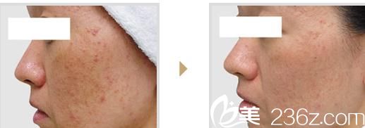 <span style= <span style=