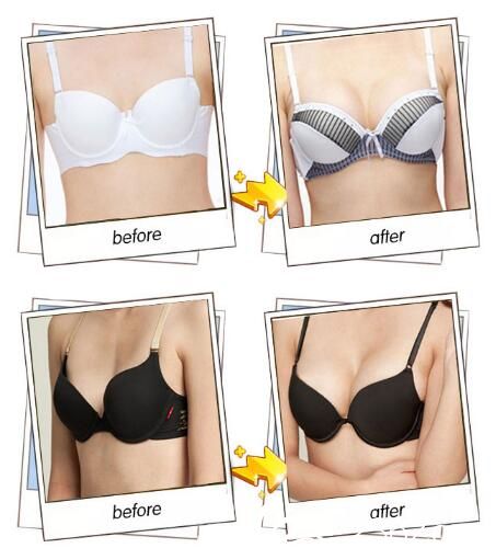 常州曙光隆胸对比照 常州曙光隆胸对比照