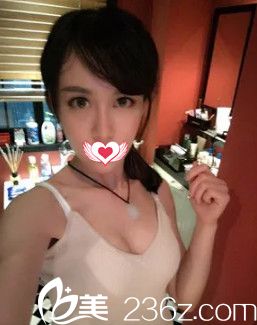 自体脂肪丰胸26天胸部变大 自体脂肪丰胸26天胸部变大