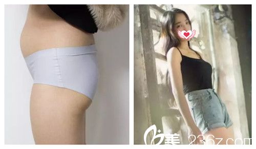 <!--<i data=20240703-sp></li>
                        </a>
                       </ul>
                    </div>
                                        <p>性感的身材是美少女们必不可少的一部分,因为就算是有精致的五官,但是整体很肥胖的话,就会使形象大打折扣,现在随着吸脂手术的出现,不仅效果显著还安全,成为很多胖MM理想的减肥方</p>
                        <div class=