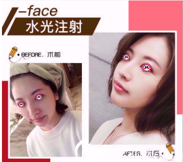 北京玲珑梵宫多少钱？德玛莎价格199元起及高春红案例公布