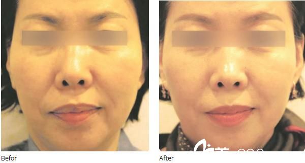 中森大记的美肌术