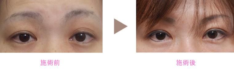 新垣形成外科医院 新垣形成外科医院