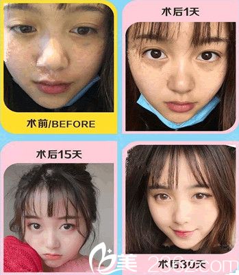 常州美贝尔怎么样?看我做完<span style= 常州美贝尔怎么样?看我做完<span style=