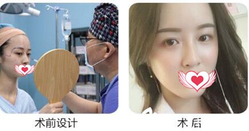 衡阳美莱自体脂肪填充<span style= 衡阳美莱自体脂肪填充<span style=