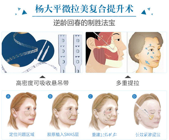 北京联合丽格杨大平微拉美复合提升术示意图 北京联合丽格杨大平微拉美复合提升术示意图