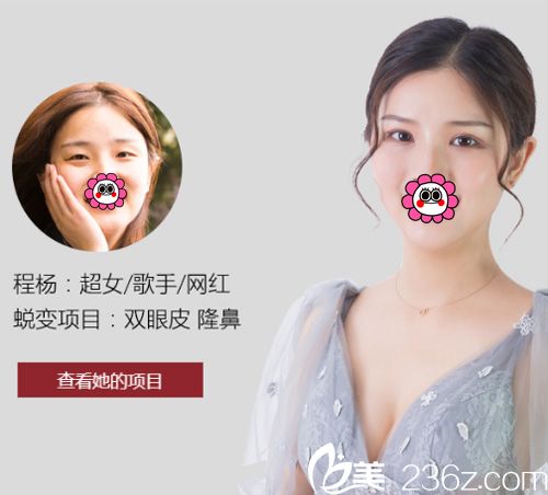 武汉艺星双眼皮案例 武汉艺星双眼皮案例