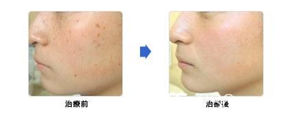 城野亲德祛斑美肌 城野亲德祛斑美肌
