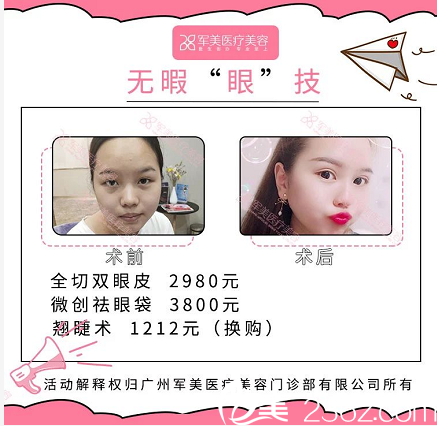 广州军美冀晨阳双眼皮案例价格表 广州军美冀晨阳双眼皮案例价格表