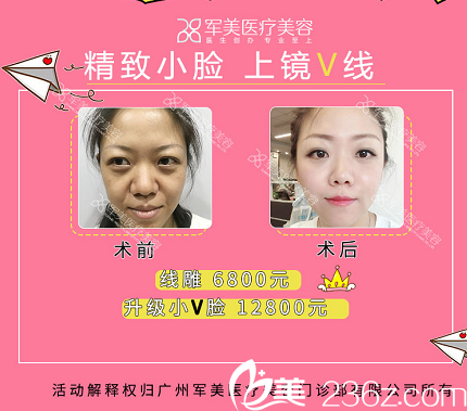 广州军美王世虎线雕案例和收费价格 广州军美王世虎线雕案例和收费价格