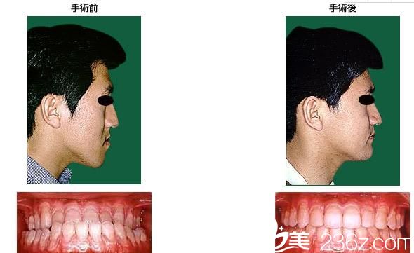 鶴木<!--<i data=20240703-sp></i>-->歯科医院鄂变形治疗 鶴木<!--<i data=20240703-sp></i>-->歯科医院鄂变形治疗