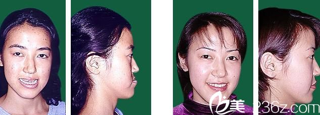 鶴木<!--<i data=20240703-sp></i>-->歯科医院鄂变形治疗 鶴木<!--<i data=20240703-sp></i>-->歯科医院鄂变形治疗