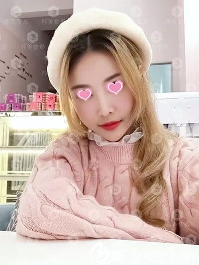 隆胸手术模特小欣 隆胸手术模特小欣