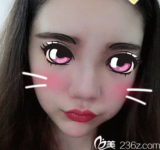 在宁波尚丽找做隆鼻前 在宁波尚丽找做隆鼻前