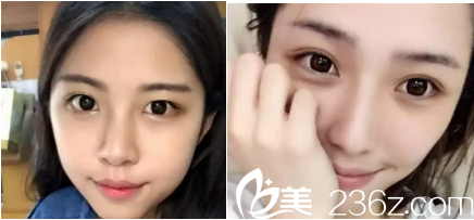 20181205_1544002585926372.png blob.png