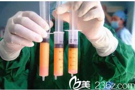 广州壹加壹脂肪填充