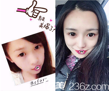 湛美整形医院樊涛<span style=