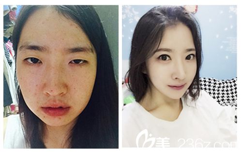 20181207_1544170863210142.jpg 对比 无水印.jpg