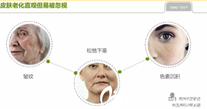 西安晶肤医院皮肤衰老图