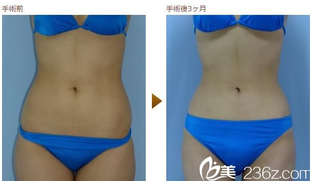 对比图片 对比图片