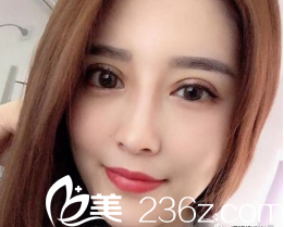 眼睛大了好多啊