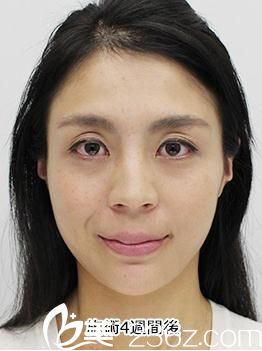 日本品川美容外科医院口碑怎么样 案例 医生 优惠价格 美佳网