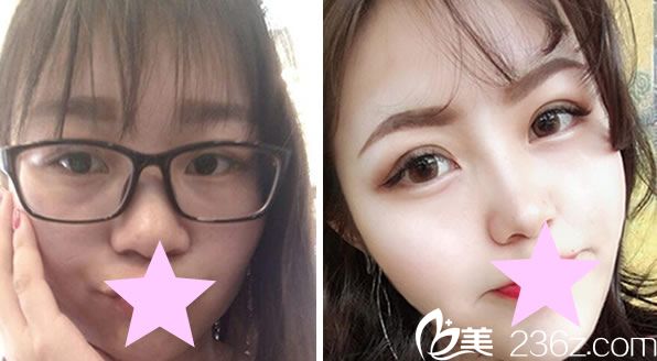 都镇雨做面部<span style= 都镇雨做面部<span style=