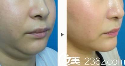 长大庭英信回春驻颜术 长大庭英信回春驻颜术