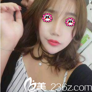 北京画美面部吸脂<span style= 北京画美面部吸脂<span style=