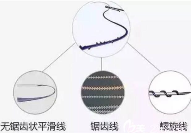 长春东方面部线雕提升线材分类