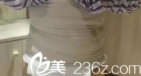 杨辉医生为我刚做完腰腹吸脂术后有肿胀感 杨辉医生为我刚做完腰腹吸脂术后有肿胀感