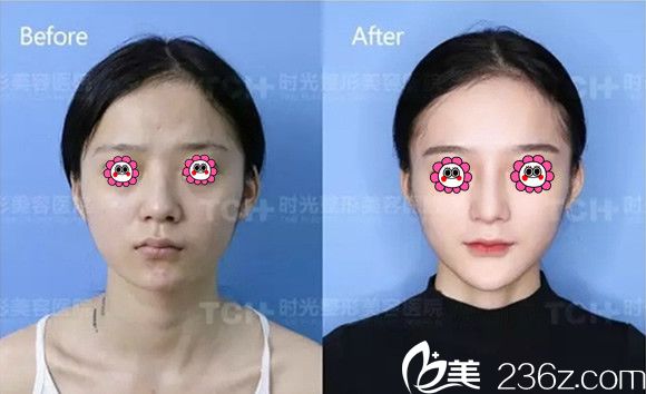 时光整形医院冯辉利<span style= 时光整形医院冯辉利<span style=