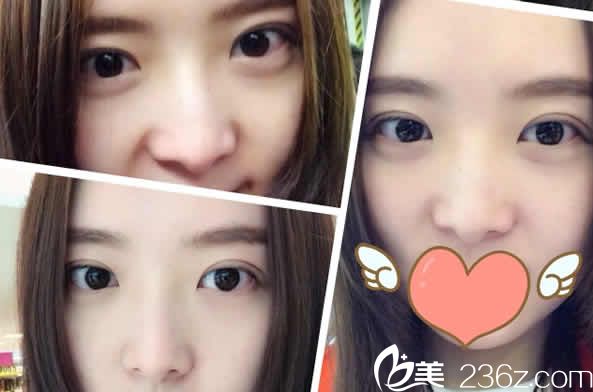 山西整形外科医院2019跨年价格表上线啦 附下颌角整形及耳再造案例