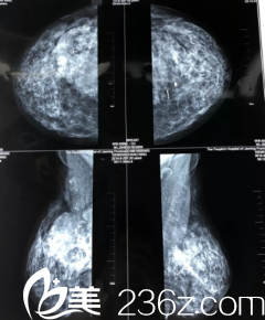 拍片之后的样子 拍片之后的样子