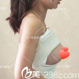 刚做完假体隆胸被纱布包裹着 刚做完假体隆胸被纱布包裹着