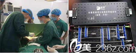 专用自体脂肪填充移植套装 专用自体脂肪填充移植套装