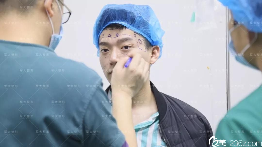 术前划线设计确定脂肪填充位置 术前划线设计确定脂肪填充位置