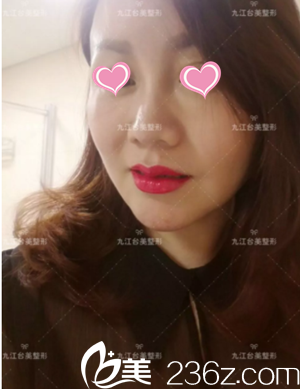 治疗15天后效果