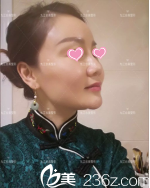 九江台美治疗案例