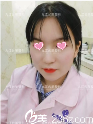 许院长给我注射瘦脸3天了